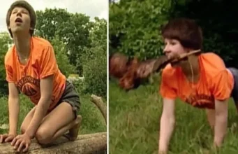 I was raised by stray dogs since I was 3 — they taught me to bark and walk on all fours I was raised by stray dogs since I was 3 — they taught me to bark and walk on all fours